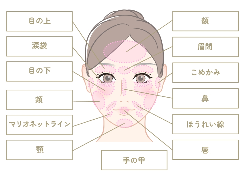 顔の各部位に関する説明が示されたイラスト。目の上、涙袋、目の下、頬、マリオネットライン、顎、手の甲、額、眉間、こめかみ、鼻、ほうれい線、唇の位置がラベル付けされています。